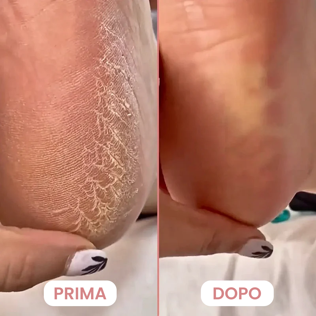 Lima Elettrica Piedi Professionale + 60 Dischi di Ricambio GRATIS